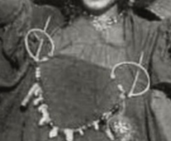 Fibula closeup Fibula closeup.